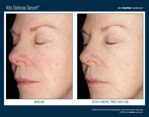 SkinBetterAlto Defense Serum