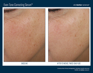 SkinBetter Even Tone Correcting Serum