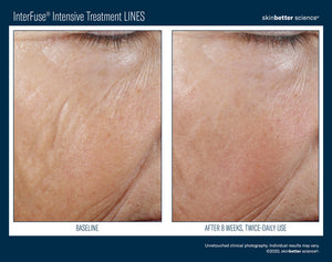 SkinBetter Interfuse Treatment Cream LINES